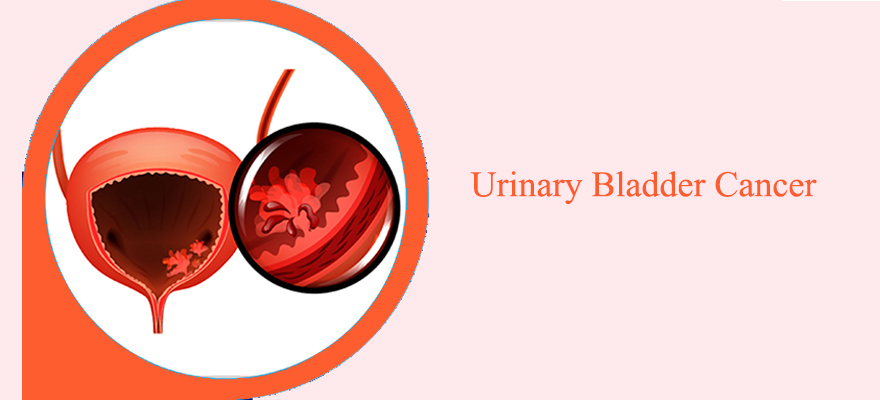 urinary-bladder-cancer