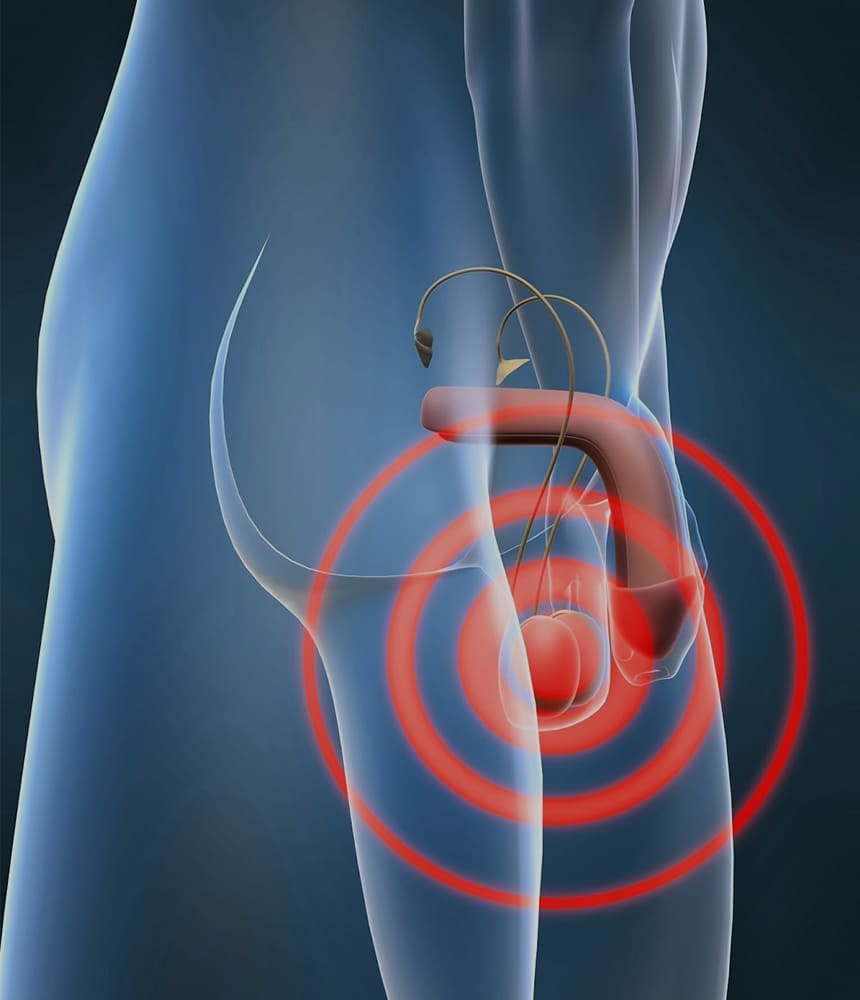 testicular-cancer-2